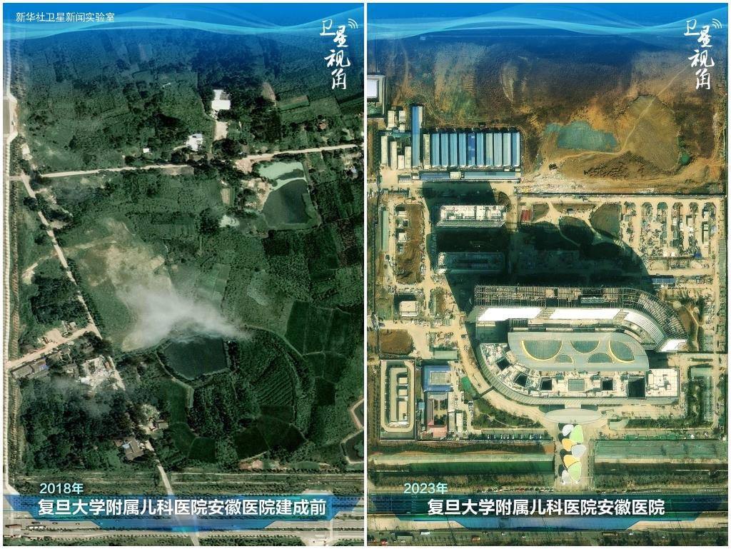 2023年與2018年相比，復旦大學附屬兒科醫(yī)院安徽醫(yī)院從一片荒地到建成投用。該項目是安徽省在長三角一體化高質(zhì)量發(fā)展衛(wèi)生健康領(lǐng)域的重大項目，也是安徽首批落地的國家區(qū)域醫(yī)療中心。